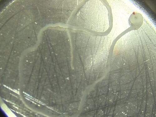 乱吃东西不注意 最后寄生虫“附体”