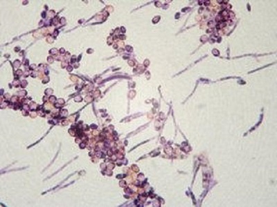 挠完脚接着掏耳朵 他的耳朵长白毛有霉菌