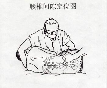 大妈跳僵尸舞 跳出腰椎骨质增生