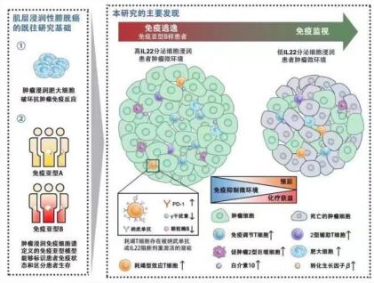 中国学者研究率先发现膀胱肿瘤免疫逃逸帮凶