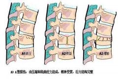 按摩床免费按摩半年 不想被按成腰椎骨折