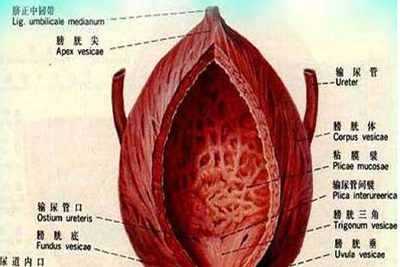 腺性膀胱炎的癌变