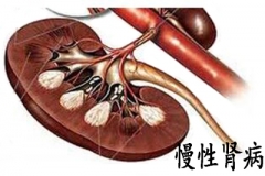 呕吐不止血压升高 一查竟患慢性肾病