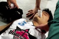 多年“羊癫疯” 谜团终揭开 竟是脑囊虫病