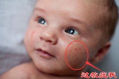 食物过敏事件频发 瞅准病因很重要