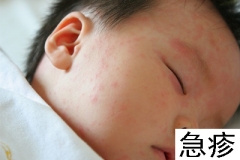 急疹、湿疹、水痘 盘点春季幼儿易患疾病