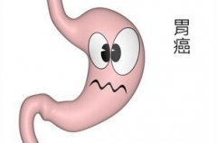 经常熬夜不过早 他高考前查出胃癌