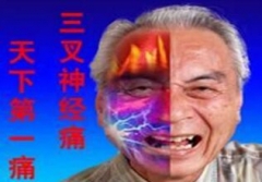 牙痛难忍张嘴都困难 竟祸起三叉神经痛