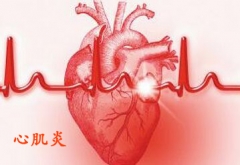 身体不适突然晕倒在地 原是心肌炎发作