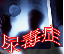 伴有恶心乏力状 警惕尿毒症盯上