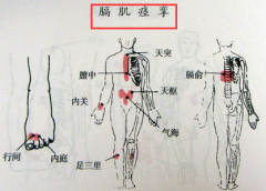连续打嗝不停 警惕顽固性膈肌痉挛