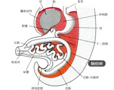 饭后剧烈运动出现腹痛 或有肠扭转可能