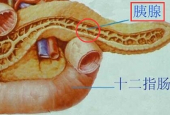 长期抽烟酗酒饮食无节制 当心胰腺癌袭击