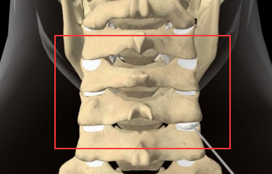 腰椎小关节紊乱