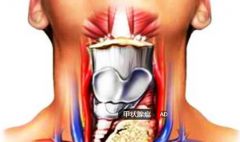 脖子前现突起且声音嘶哑 祸源甲状腺癌