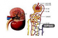 小伙连续加班致浑身瘫软 低钾血症要怎样吃