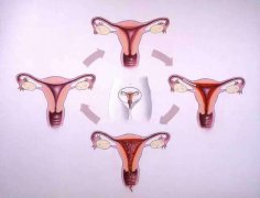 改善子宫内膜厚偏方